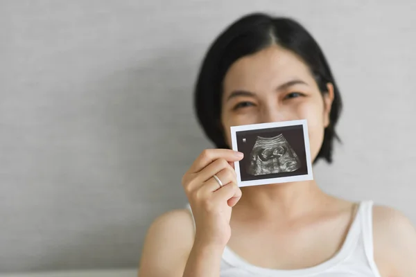 超音波スキャン写真を示す幸せな若い妊娠中の女性 生まれていない赤ちゃんのソノグラムでアジアの母を笑顔 妊娠の概念 コピースペースと妊産婦のケア — ストック写真