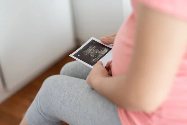 ベッドの上で超音波画像を保持して座っているアジアの妊婦の閉鎖 生まれていない赤ん坊のソノグラムを持つ母親 妊娠の概念 妊産婦のケア — ストック写真