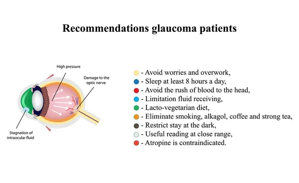 Glaucoma. Recomendações pacientes com glaucoma. A estrutura do olho. Infográficos. Ilustração vetorial sobre fundo isolado — Vetor de Stock