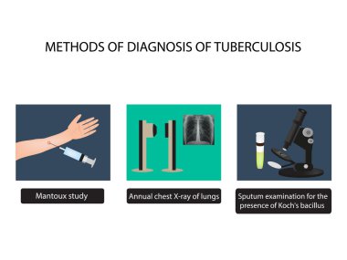 TB tanı yöntemleri. X-ışınları ışık. Mantoux testi. Balgam incelenmesi. Dünya tüberküloz günü. Infographics.