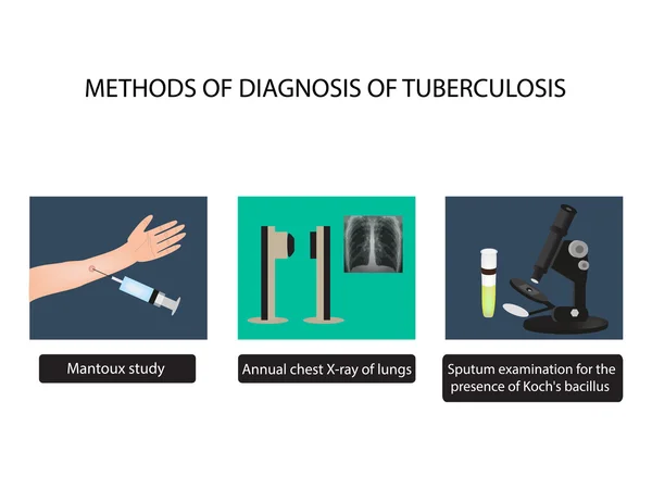 Métodos de diagnóstico de TB. Raios-X de luz. Teste de Mantoux. Exame do escarro. Dia Mundial da Tuberculose. Infográficos . — Vetor de Stock