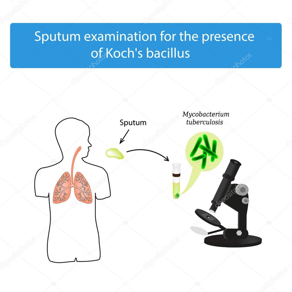 Sputum examination. World Tuberculosis Day. Infographics. Vector illustration on isolated background