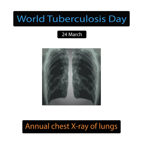 Rayos X de luz. Diagnóstico de tuberculosis. Ilustración vectorial sobre fondo aislado — Vector de stock