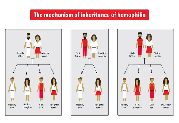 Il meccanismo di ereditarietà dell'emofilia. Infografica. Illustrazione vettoriale su sfondo isolato — Vettoriale Stock