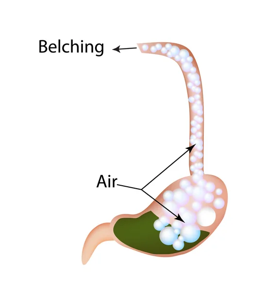 Belching. Air in the stomach. The structure of the esophagus and stomach. Infographics. Vector illustration — Stock Vector