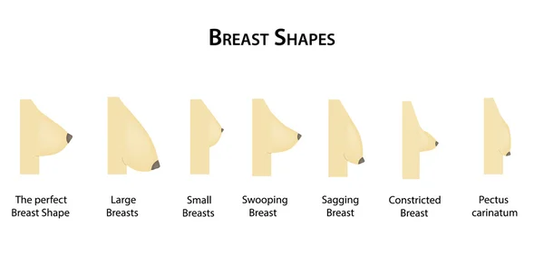 Forma il seno. Illustrazione vettoriale su sfondo isolato — Vettoriale Stock