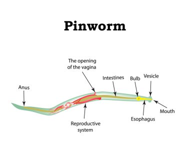 Pinworms yapısı. Pinworm. Vektör illüstrasyon izole arka plan üzerinde