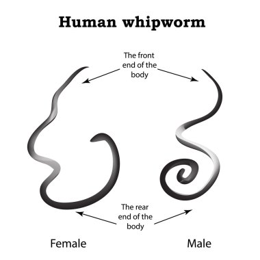 Whipworm. Yapı whipworm kadın. Erkek whipworm yapısı. Infographics. Vektör illüstrasyon izole arka plan üzerinde