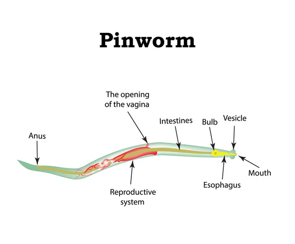Struktura owsiki. Pinworm. Ilustracja wektorowa na na białym tle — Wektor stockowy