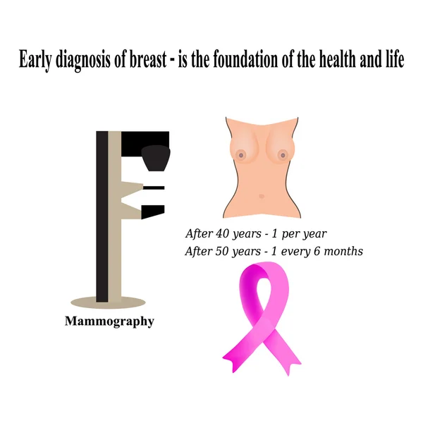 Mammografia. Diagnosi del cancro al seno. Diagnosi delle cisti nel seno. La lotta contro il cancro al seno. Cancro al nastro rosa. Illustrazione vettoriale su sfondo isolato — Vettoriale Stock