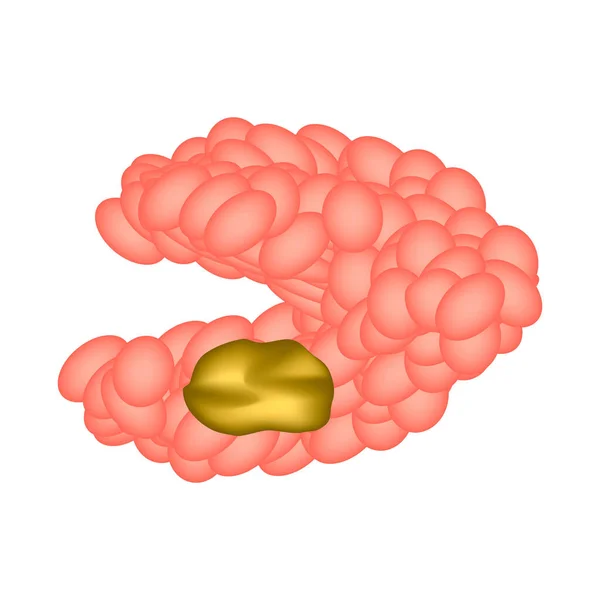 Quiste de glándula salival submandibular. Estructura de la glándula salival submandibular. Ilustración vectorial sobre fondo aislado — Vector de stock