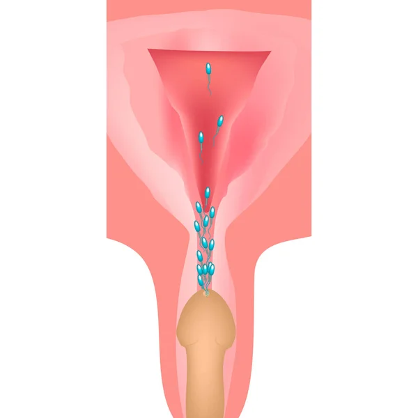 L'éjaculation. L'éjaculation dans le tractus génital. La structure de l'utérus et des ovaires. Illustration vectorielle sur fond isolé — Image vectorielle