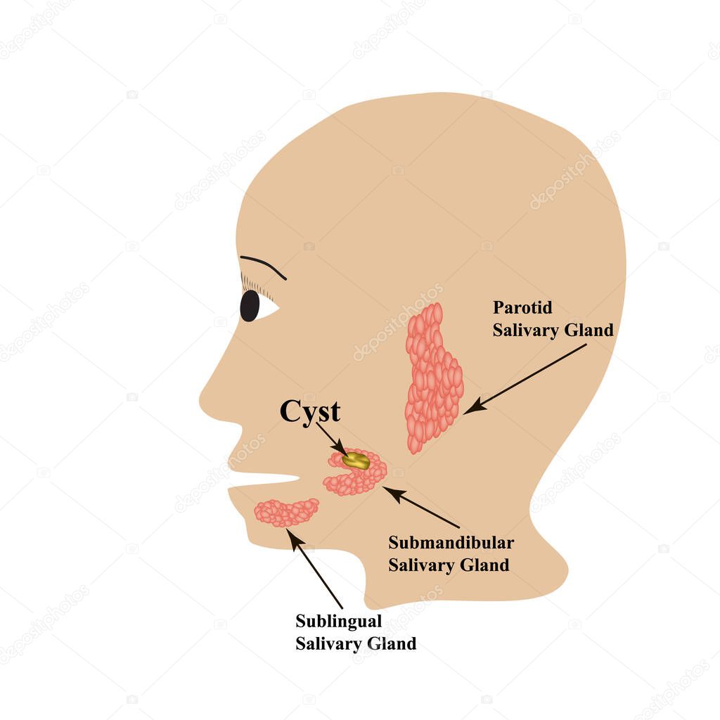 Parotid salivary gland. Submandibular salivary gland. Sublingual salivary gland. cyst. Vector illustration on isolated background
