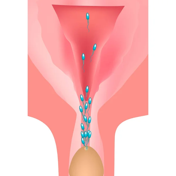 L'éjaculation. L'éjaculation dans le tractus génital. La structure de l'utérus et des ovaires. Illustration vectorielle sur fond isolé — Image vectorielle