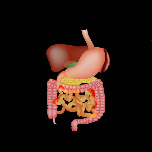 Estrutura anatômica dos órgãos abdominais. Baço, fígado, vesícula biliar, estômago, intestinos, cólon, pâncreas. Ilustração vetorial —  Vetores de Stock