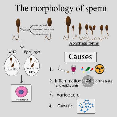 Infographics sperm morfolojisi.