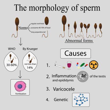 Infographics sperm morphology. clipart