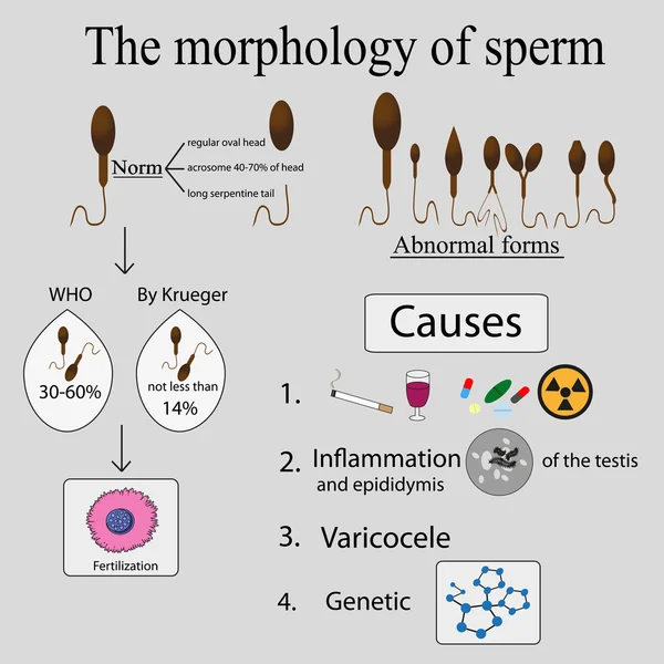 Infographics sperm morphology. — Stock Vector