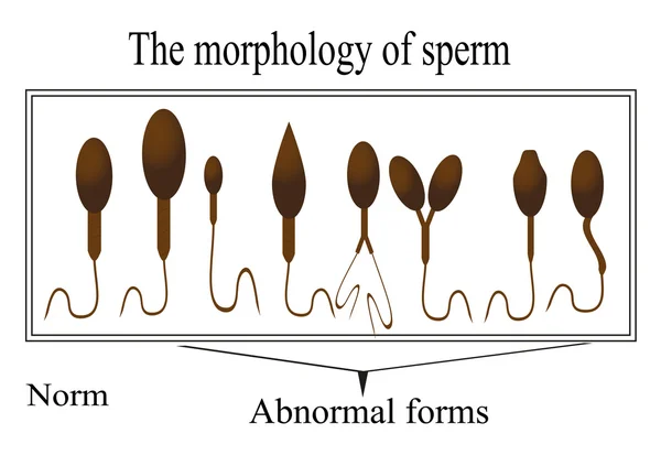 A morfologia do esperma. Estrutura espermática normal e anormal — Vetor de Stock