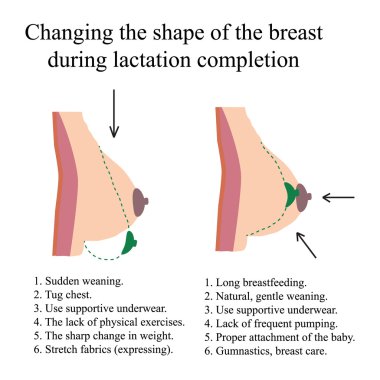 Changing the shape of the breast during lactation completion. clipart