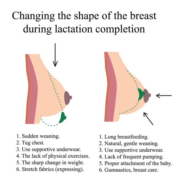 Változó alakja a mell, szoptatás alatt. — Stock Vector