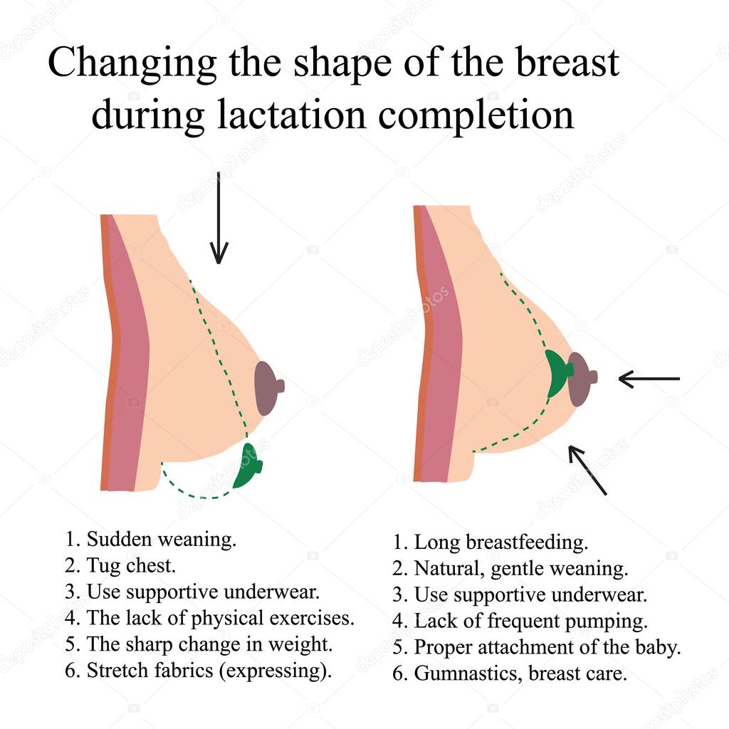 Changing the shape of the breast during lactation completion.