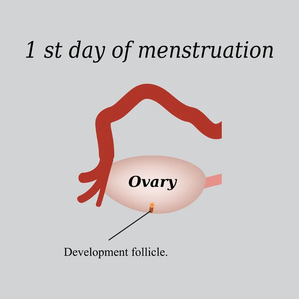 Den första dagen av menstruationen - utvecklingen av folliklar i äggstockarna. Vektor illustration på en grå bakgrund — Stock vektor