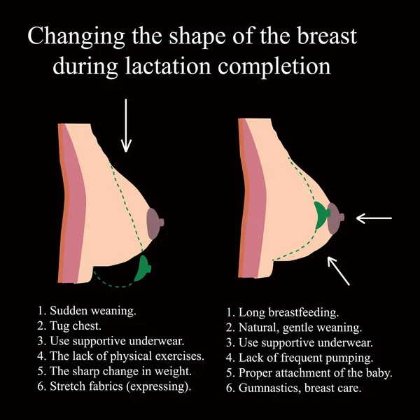 Alterar a forma da mama durante a conclusão da lactação . —  Vetores de Stock