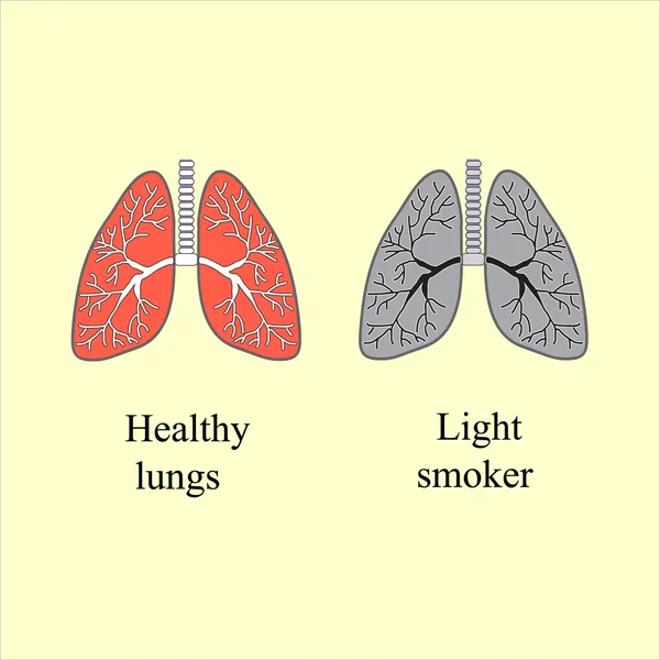 Fumador ligero. El daño de fumar. Ilustración vectorial — Archivo Imágenes Vectoriales