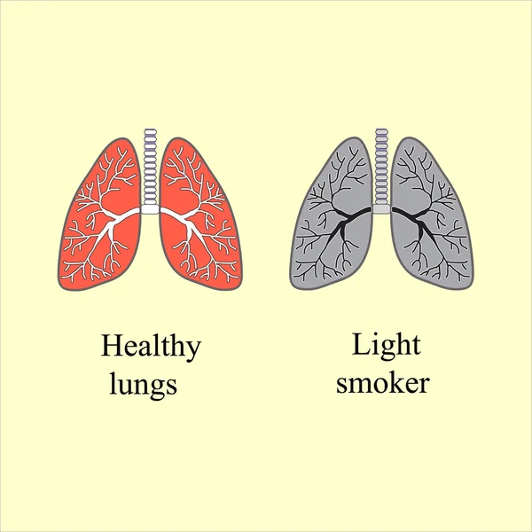 Light smoker. The harm of smoking. Vector illustration — Stock Illustration Light smoker. The harm of smoking. Vector illustration Stock Illustration