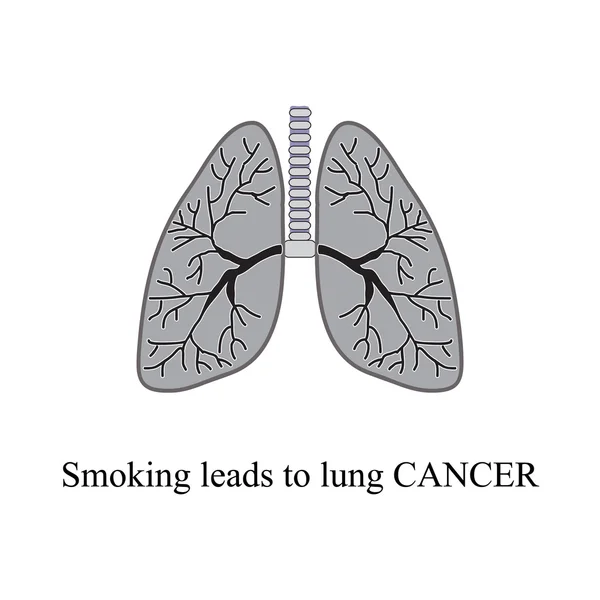 Smoking leads to lung cancer. Vector illustration on isolated background — Stock Illustration Smoking leads to lung cancer. Vector illustration on isolated background Royalty Free Stock Illustrations