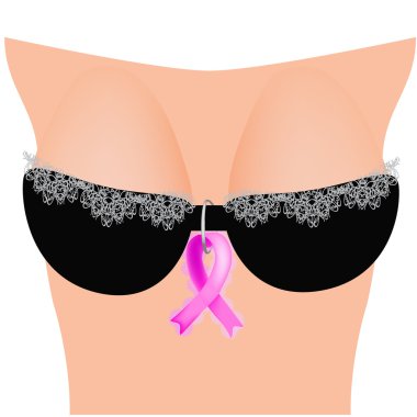 Güzel dantelli siyah sutyen pembe kurdele kanserli bulunan kadın büstü