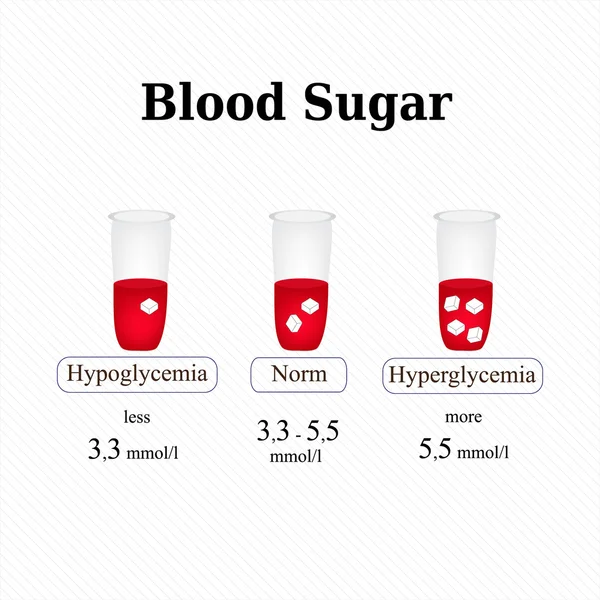 Hladina cukru v krvi. Hypoglykémie. Hyperglykémie. Infografiky. Vektorové ilustrace — Stockový vektor