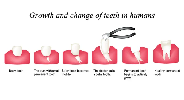 Crecimiento y cambio de dientes en humanos. Etapas de desarrollo de los dientes. Infografías. Ilustración vectorial sobre fondo aislado — Archivo Imágenes Vectoriales