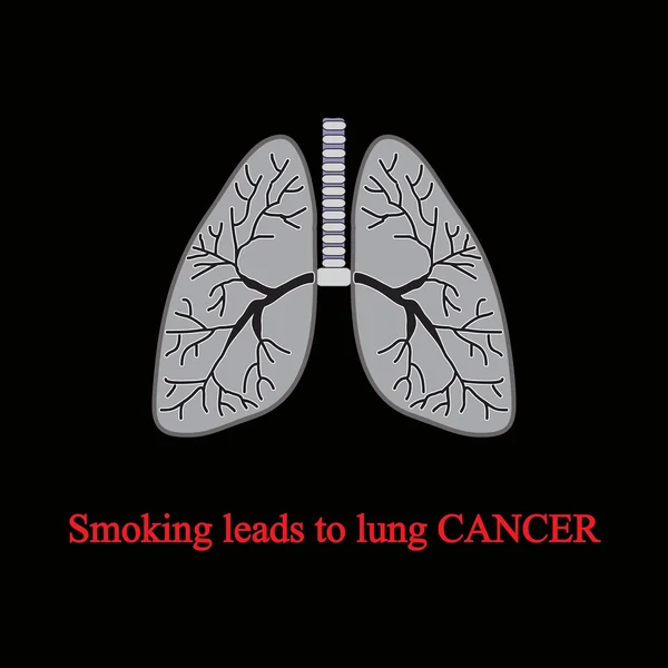 Rökning leder till lungcancer. Vektor illustration på svart bakgrund — Stock vektor