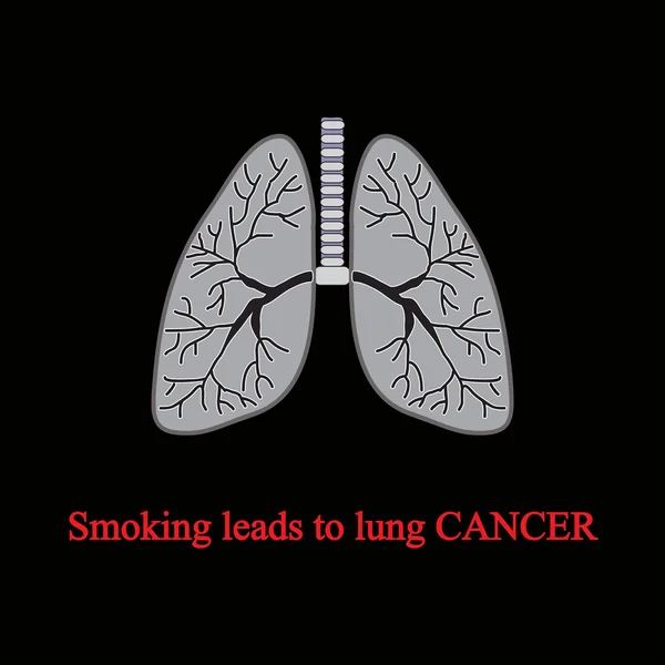 Smoking leads to lung cancer. Vector illustration on a black background — Stock Illustration Smoking leads to lung cancer. Vector illustration on a black background Vector Graphics
