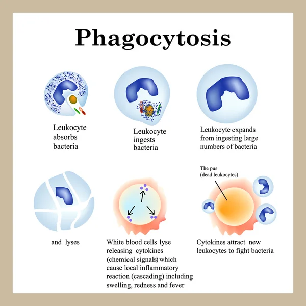 Phagocytose. Le processus de destruction des bactéries par les leucocytes. Illustration vectorielle isolée sur fond blanc — Image vectorielle