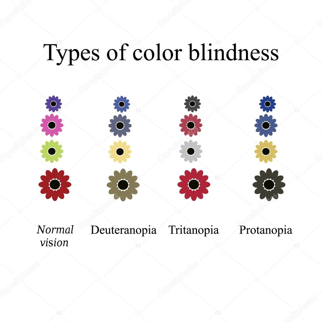 Types of color blindness. Eye color perception. Vector illustration on isolated background