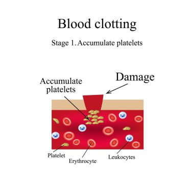 Blood clotting. Stage 1. Infographics. Vector illustration clipart