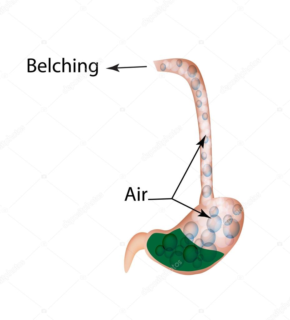 Belching. Air in the stomach. The structure of the esophagus and stomach. Infographics. Vector illustration