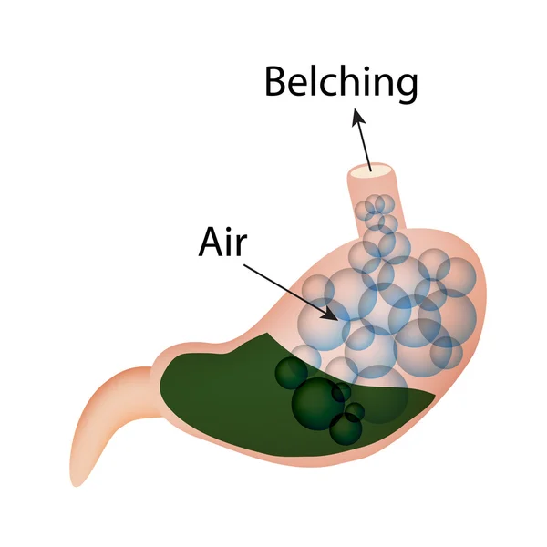 Belching. Air in the stomach. The structure of the esophagus and stomach. Infographics. Vector illustration — Stock Vector