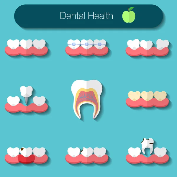 Dental care flat design Vector illustration of heathy theeth, caries, braces system, implantation, and other dental health icons set — Stok Vektör