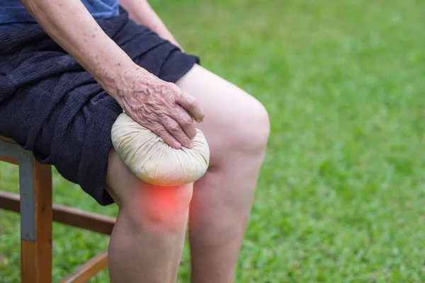 Yaşlılarda diz ağrısı. Diz ağrısı olan yaşlı bir kadın dizini indirmek için Thai bitkisel kompres topu kullanıyor. Diz ağrısı kas gerginliği, tendinoz, osteoartrit (OA).