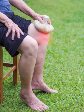 Yaşlı bir insanda diz ağrısı. Yaşlı kadın dizinde Tayland bitkisel kompres topu kullanıyor. Diz ağrısı kas tendinozu, osteoartrit (OA) kaynaklı olabilir. Yaşlılar ve sağlık konsepti.