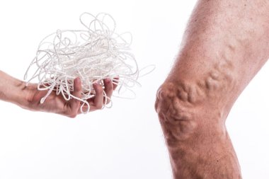 a tangle of ropes with a man being ill with varicose veins of th clipart