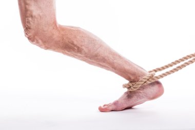 rope holding human leg ailing varicose veins of the lower extrem