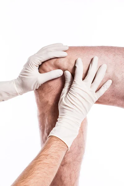 Doctor in medical gloves examines a person with varicose veins o — Stock fotografie