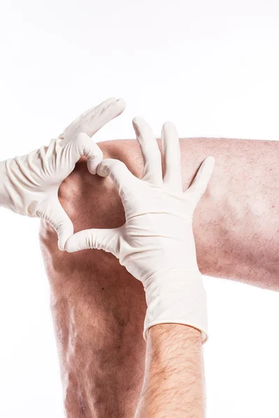 Dokter dalam sarung tangan medis memeriksa seseorang dengan vena varicose o — Stok Foto
