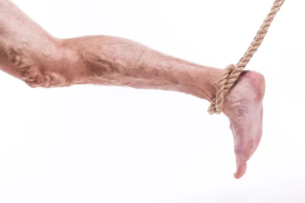 Rope holding human leg ailing varicose veins of the lower extrem — Stockfoto