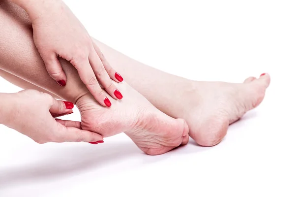 Suchá dehydratovaná kůže na paty ženské nohy s mozoly Stock Snímky